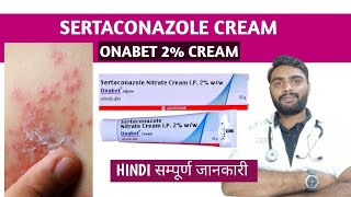 Sertaconazole cream in hindi  Onabet cream  Sertaconazole ointment [upl. by Aynotal]