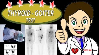 Thyroid Goiter Test RAIU  WHEN  WHAT IS IT [upl. by Drofnelg550]