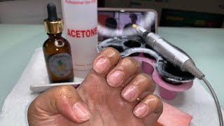 How To Remove Acrylic Nails  Soak Off Nails  Acrylic Nails Removal [upl. by Livvi205]