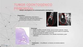 Quistes y tumores odontogenicos parte 2 [upl. by Ahsirtak728]