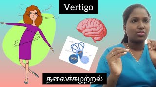 Vertigo  தலைச்சுழற்றல்  In Tamil vertigo physiotherapy treatment dizziness health neurology [upl. by Kameko389]