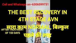 The best recovery in 4th stage Avn avascular avntreatment patient from chhatisgarh [upl. by Eilyw]