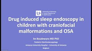 DrugInduced Sleep Endoscopy webinar  An Boudewyns [upl. by Aytida]