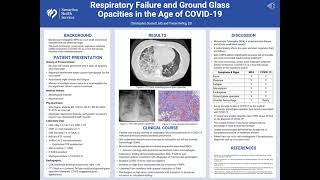 Respiratory Failure and Ground Glass Opacities in the Age of COVID19 [upl. by Asir894]