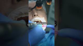 What Happens to The Abscess After Tooth Extraction  Dental Abscess  Daily Dentists [upl. by Uttasta]