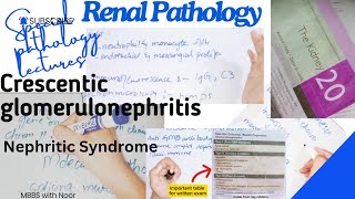 crescentic glomerulonephritis  renal pathology  nephritic syndrome  Drsamcrest [upl. by Mcconaghy598]