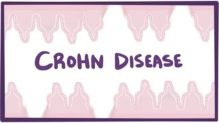 Crohns disease Crohn disease  causes symptoms amp pathology [upl. by Verdie]