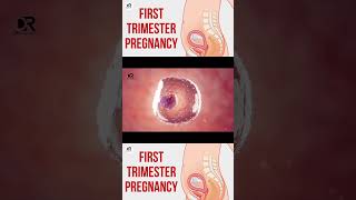 First Trimester Pregnancy 🤱🏻🤰🏻 pregnancyguide PrenatalCare HealthyPregnancy pregnancyhealth [upl. by Ronna]