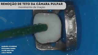 Cirurgia de acesso MOLAR SUPERIOR [upl. by Ron]