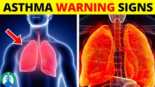 Top Early Warning Signs of Asthma That You Should NEVER IGNORE [upl. by Row]