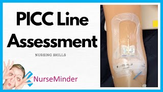 PICC Line Assessment Nursing Skills [upl. by Thomas629]