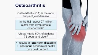 Osteoarthritis Prevention Detection and Treatment [upl. by Ettenoitna]