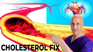 The Most Effective Way to Lower Your Cholesterol Naturally in 7 Days Dr Mandell [upl. by Retrac863]