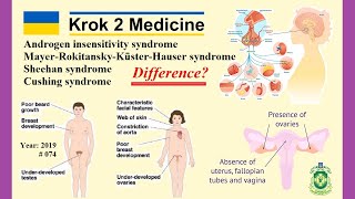 Krok 2 Medicine  Year 2019  074 Ministry of Public Health of Ukraine [upl. by Ettenahs]