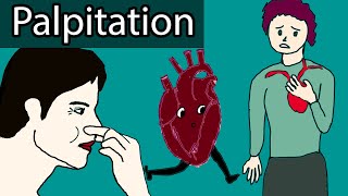 Heart Palpitations  Causes When to worry about heart palpitations [upl. by Puiia]