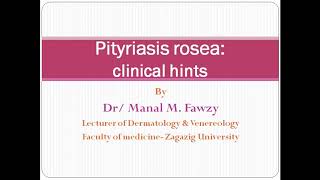 Pityriasis rosea clinical hints [upl. by Gnuy]