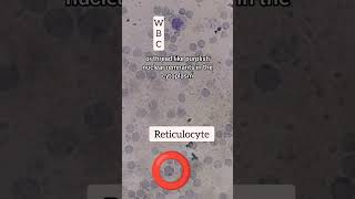 How to do microscopy and calculate reticulocyte count Reticulocyte count Part 2 [upl. by Polish]