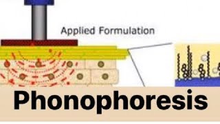 PHONOPHORESIS [upl. by Hollah]