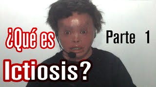 VideoBlog  ¿Qué es Ictiosis 1ra Parte [upl. by Jegger]