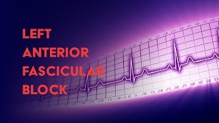 Left Anterior Fascicular Block  How to Read an Electrocardiogram EKG  MEDZCOOL [upl. by Llener]