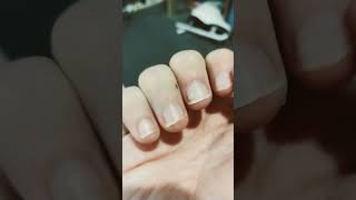 Day 12 of not biting my nails stopnailbiting [upl. by Rexford756]