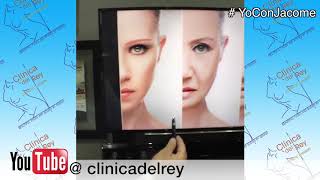 lipotransferencia facial Clínica del Rey [upl. by Jeremy]