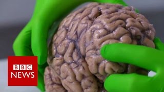 Up close with a human brain  BBC News [upl. by Adriell]