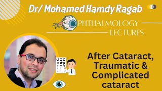 Lens 4 After Cataract Traumatic amp Complicated cataract [upl. by Siffre344]