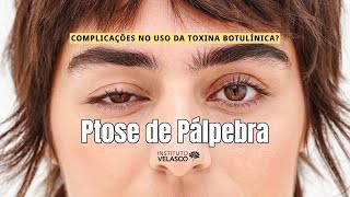 Deu Ruim Ptose Palpebral Complicações no uso da Toxina Botulínica Harmonização Facial [upl. by Jacey532]