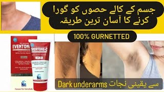 Whitening of Dark underarms  Eventone C cream uses [upl. by Rodriguez]