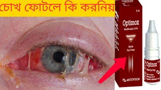 চোখ ফোটা বা চোখে ময়লা হলে ব্যবহার করুন quot Optimox Eye drop quot [upl. by Francesco898]