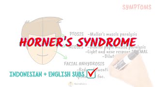 Horners syndrome pathophysiology  Neuroaholics [upl. by Nylzor]