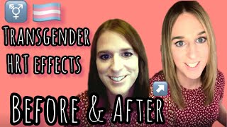 Trans HRT effects MTF Before and After [upl. by Clarette]