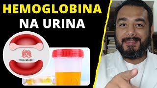 Qual o significado de hemoglobina positiva na urina hemoglobinúria no exame de urina tipo 1 [upl. by Reece]