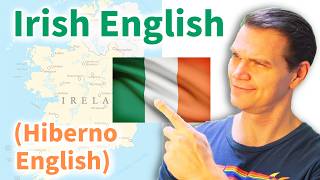 IRISH English and What Makes it Different [upl. by Pizor]