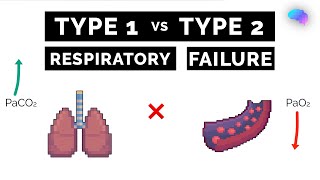 Type 1 vs Type 2 Respiratory Failure  ABG Interpretation  UKMLA  CPSA [upl. by Falcone273]