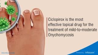 Ciclopirox is the most effective topical drug for the treatment of mildtomoderate Onychomycosis [upl. by Orelie115]