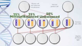 Genetics Presentation  Balance Translocation [upl. by Mauri540]