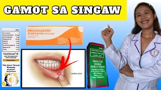 SINTOMAS DAHILAN AT GAMOT SA SINGAW SA BIBIG AT LABI  SINGAW SA BIBIG TREATMENT [upl. by Einned]