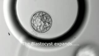 Blastocyst Development  Day 3 to Day 5 MUST SEE [upl. by Zacek]