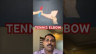 Cozens test for tennis elbow [upl. by Nivled]