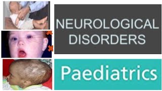 13last Neurological Disorders Paediatrics  Breath Holding Spells Pseudo seizure Hydrocephalus [upl. by Nhaj]