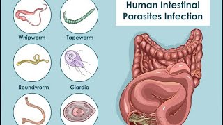 Parasitology fascioliasis 🪱 [upl. by Medarda60]