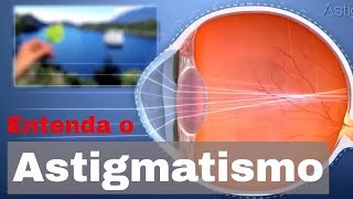 Entenda o astigmatismo [upl. by Ybrek]