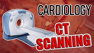 What is a CT Angiogram CTA of the Heart [upl. by Bound]