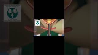 “Understanding Cystoscopy Procedure Preparation and Recovery  What to Expect [upl. by Oiracam]