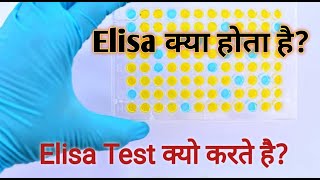 Elisa test  what is elisa in hindi [upl. by Mariano]