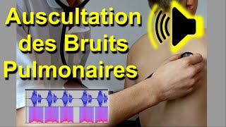 Bruits pulmonaires anormaux Auscultation Son Audio Poumon murmure vésiculaire frottement pleural [upl. by Cott]