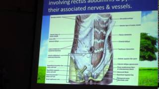 2 Dr Sherif Zaki 10022015 Muscles Fascia transversalis amp Blood supply [upl. by Marylee]