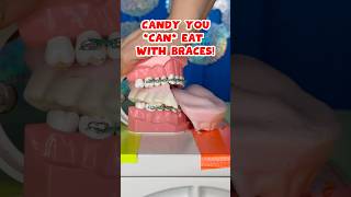 3 BEST and WORST HALLOWEEN CANDY for BRACES  TEETH 🎃👻🦷 braces candy crunchy [upl. by Aissak]